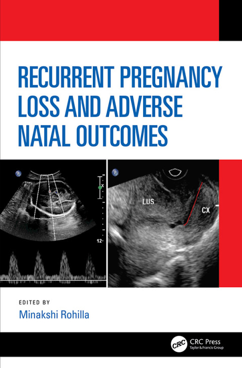 Cover image for book Recurrent Pregnancy Loss and Adverse Natal Outcomes