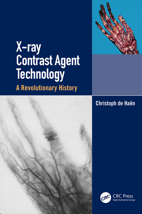 Cover image for book X-ray Contrast Agent Technology