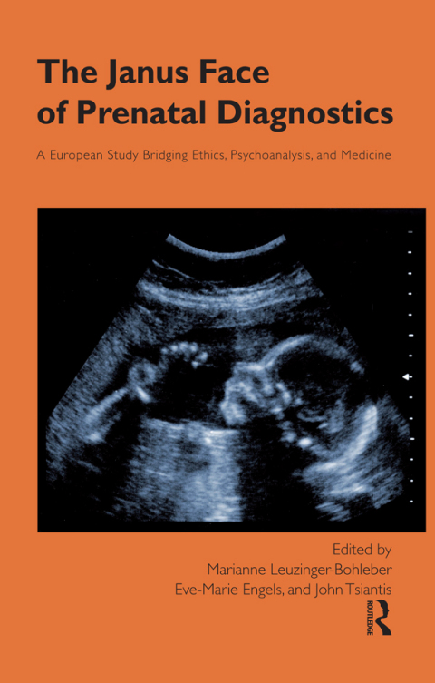 Cover image for book The Janus Face of Prenatal Diagnostics