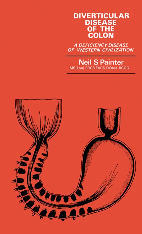 Cover image for book Diverticular Disease of the Colon: A Deficiency Disease of Western Civilization