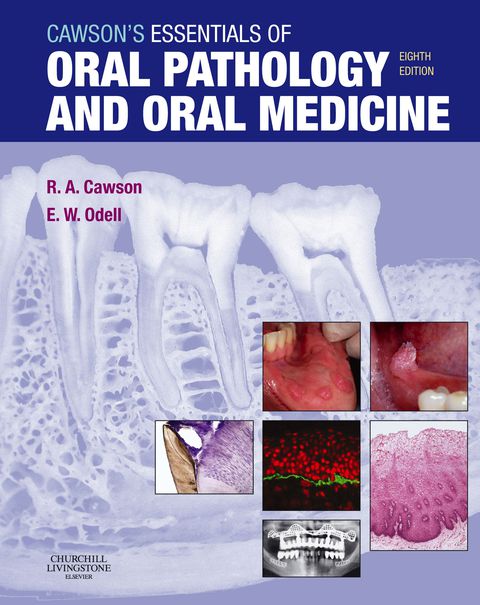 Cover image for book Cawson's Essentials of Oral Pathology and Oral Medicine