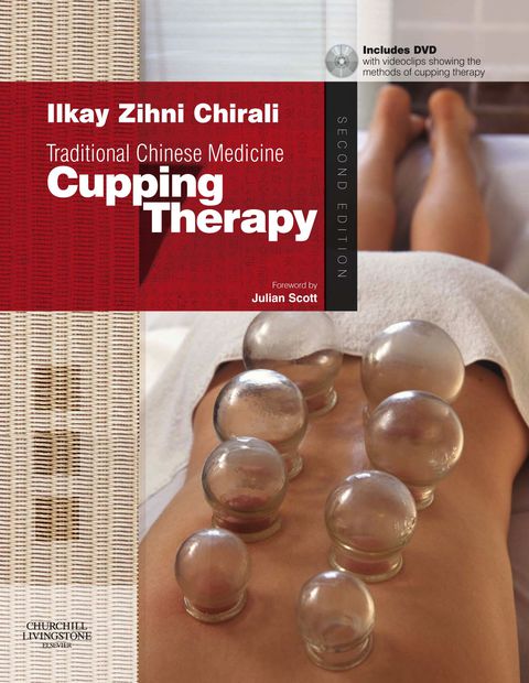 Cover image for book Traditional Chinese Medicine: Cupping Therapy