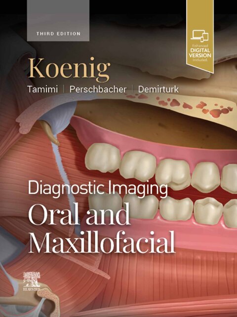 Cover image for book Diagnostic Imaging: Oral and Maxillofacial