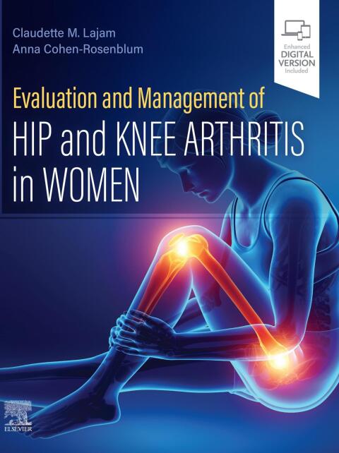 Cover image for book Evaluation and Management of Hip and Knee Arthritis in Women
