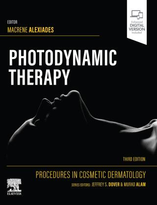 Procedures in Cosmetic Dermatology Series: Photodynamic Therapy