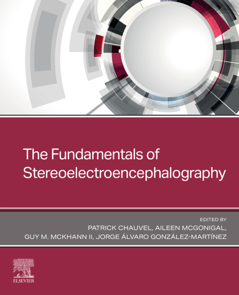 Cover image for book The Fundamentals of Stereoelectroencephalography