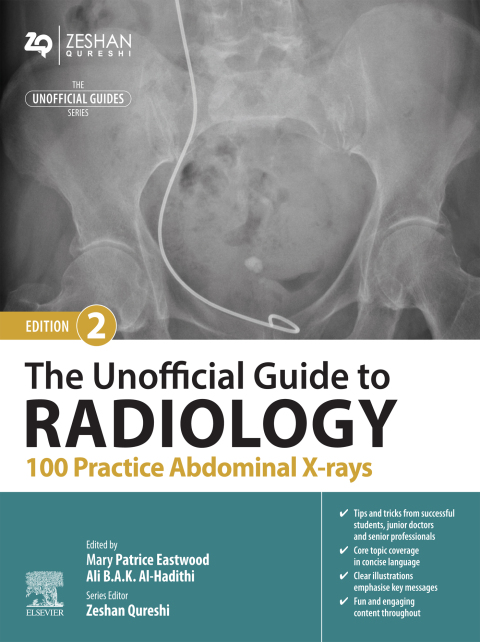 The Unofficial Guide to Radiology: 100 Practice Abdominal X-rays 