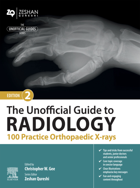 The Unofficial Guide to Radiology: 100 Practice Orthopaedic X-rays 