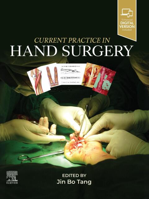 Current Practice in Hand Surgery 