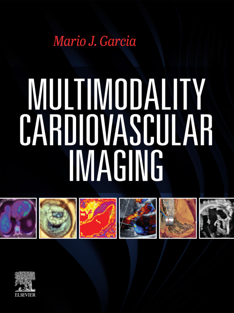 Cover image for book Multimodal Cardiac Imaging