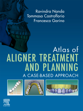 Atlas of Aligner Treatment and Planning