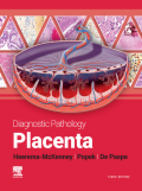 Diagnostic Pathology: Placenta 