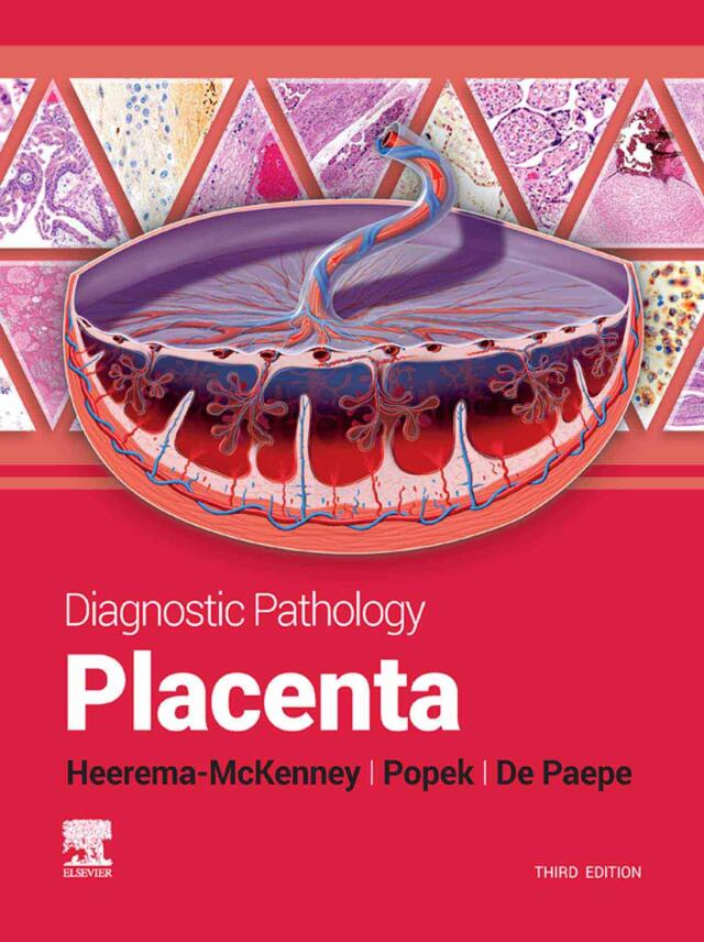 Diagnostic Pathology: Placenta