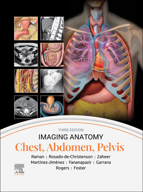Cover image for book Imaging Anatomy: Chest, Abdomen, Pelvis