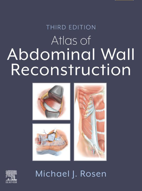 Atlas of Abdominal Wall Reconstruction 