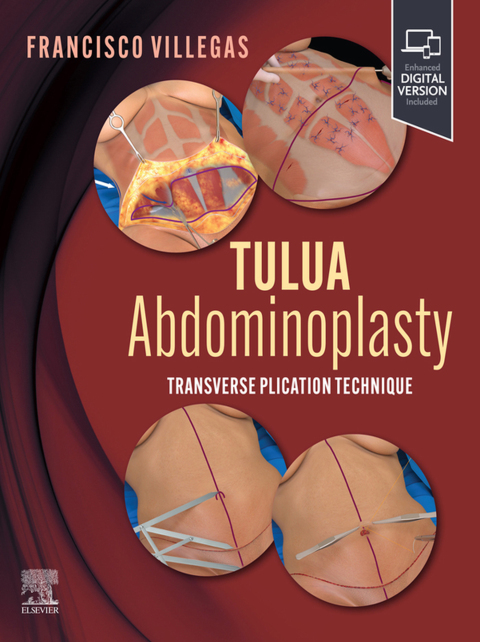 Cover image for book TULUA Abdominoplasty