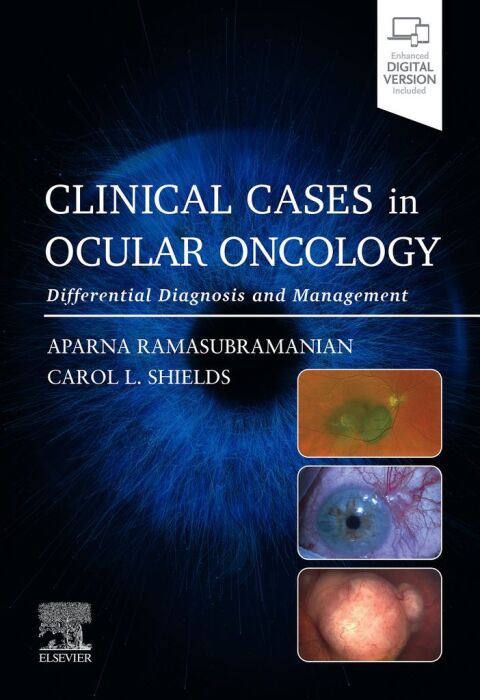Clinical Cases in Ocular Oncology 