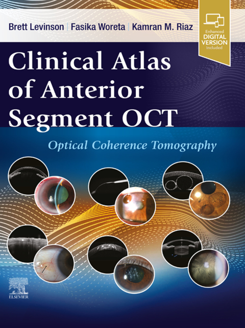 Cover image for book Clinical Atlas of Anterior Segment OCT: Optical Coherence Tomography