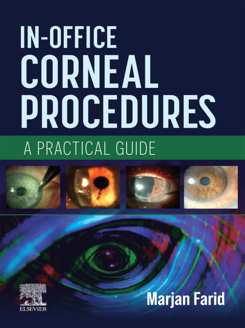 Cover image for book In-Office Corneal Procedures