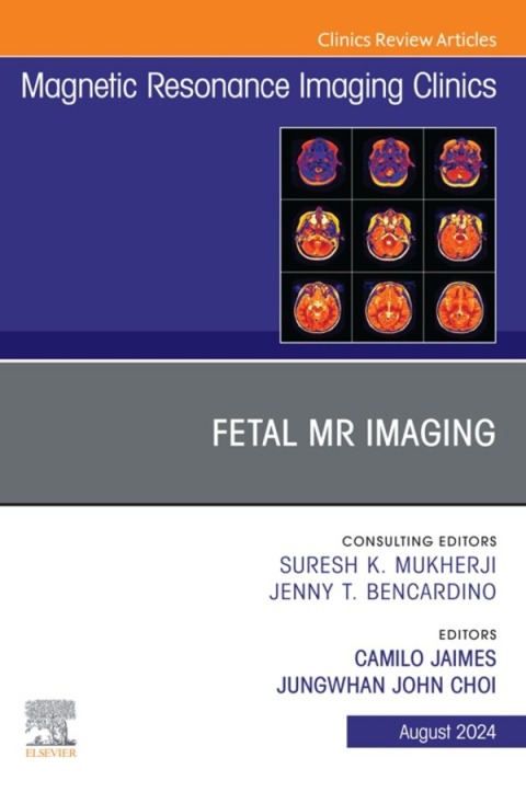 Cover image for book Fetal MRI, An Issue of Magnetic Resonance Imaging Clinics of North America