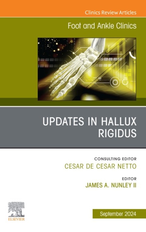 Cover image for book Updates in Hallux Rigidus, An issue of Foot and Ankle Clinics of North America