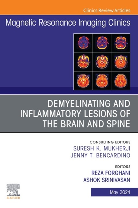 Cover image for book Demyelinating and Inflammatory Lesions of the Brain and Spine, An Issue of Magnetic Resonance Imaging Clinics of North America
