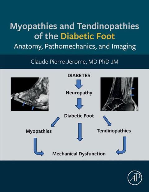 Cover image for book Myopathies and Tendinopathies of the Diabetic Foot