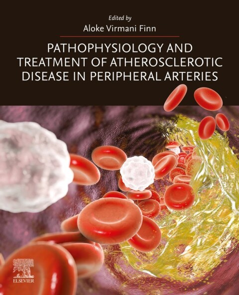 Cover image for book Pathophysiology and Treatment of Atherosclerotic Disease in Peripheral Arteries