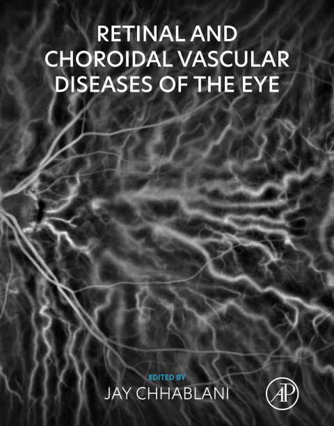 Cover image for book Retinal and Choroidal Vascular Diseases of the Eye