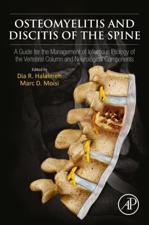 Cover image for book Osteomyelitis and Discitis of the Spine