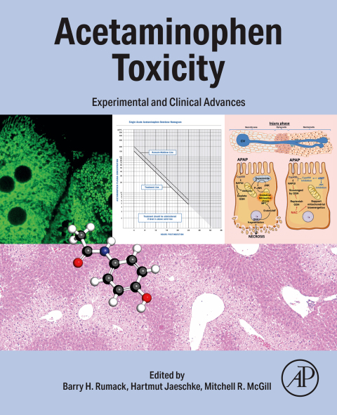 Acetaminophen Toxicity 