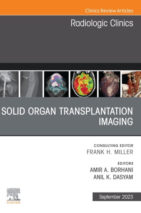 Cover image for book Solid organ transplantation imaging, An Issue of Radiologic Clinics of North America