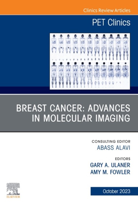 Cover image for book Breast Cancer: Advances in Molecular Imaging, An Issue of PET Clinics,