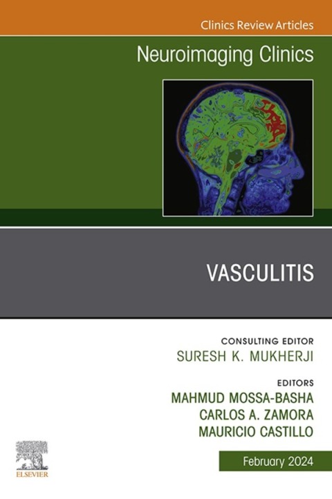 Cover image for book Vasculitis, An Issue of Neuroimaging Clinics of North America
