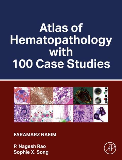 Cover image for book Atlas of Hematopathology with 100 Case Studies