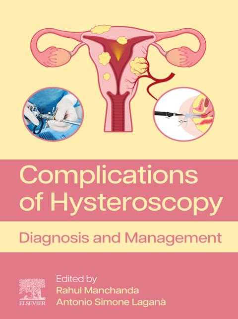 Cover image for book Complications of Hysteroscopy