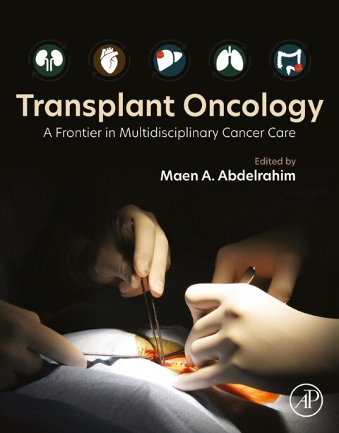 Cover image for book Transplant Oncology