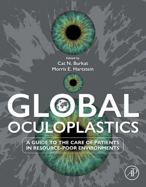 Cover image for book Global Oculoplastics