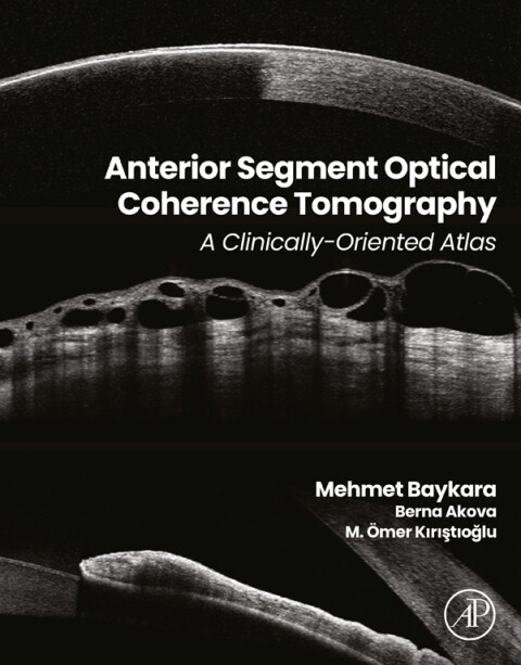 Cover image for book Anterior Segment Optical Coherence Tomography