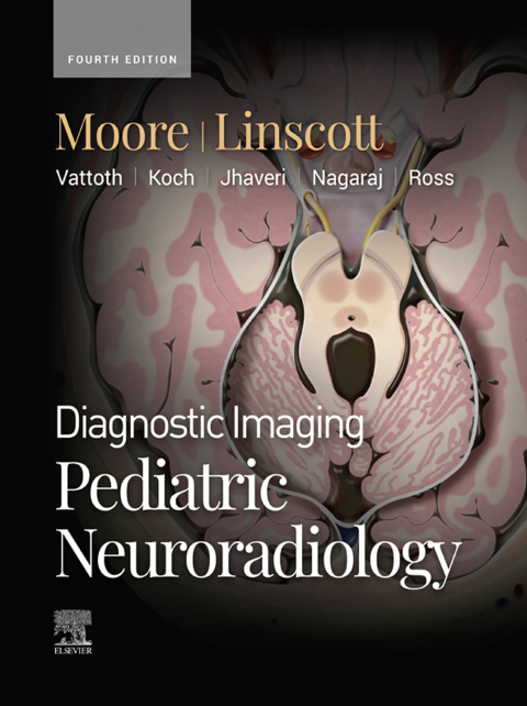 Cover image for book Diagnostic Imaging: Pediatric Neuroradiology