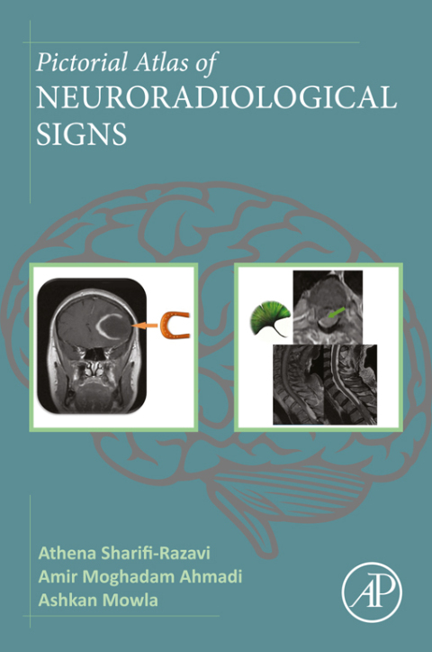 Cover image for book Pictorial Atlas of Neuroradiological Signs