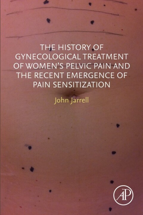 Cover image for book The History of Gynecological Treatment of Women’s Pelvic Pain and the Recent Emergence of Pain Sensitization