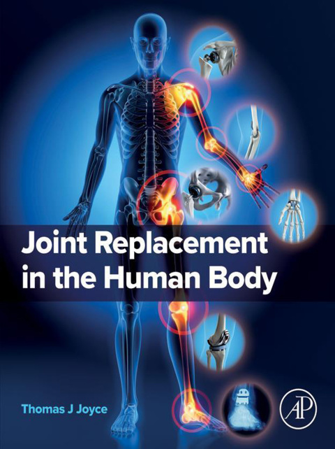 Cover image for book Joint Replacement in the Human Body
