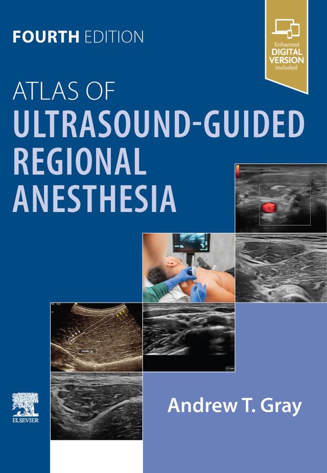 Atlas of Ultrasound-Guided Regional Anesthesia