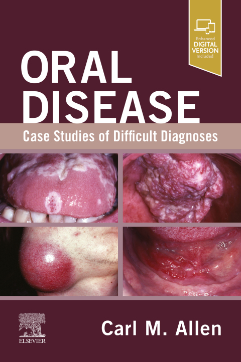 Cover image for book Oral Disease