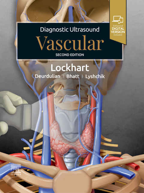 Cover image for book Diagnostic Ultrasound: Vascular