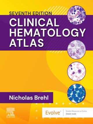 Clinical Hematology Atlas -E-Book