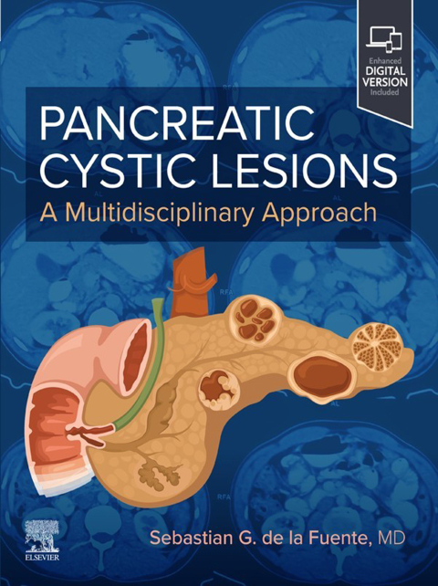 Cover image for book Pancreatic Cystic Lesions