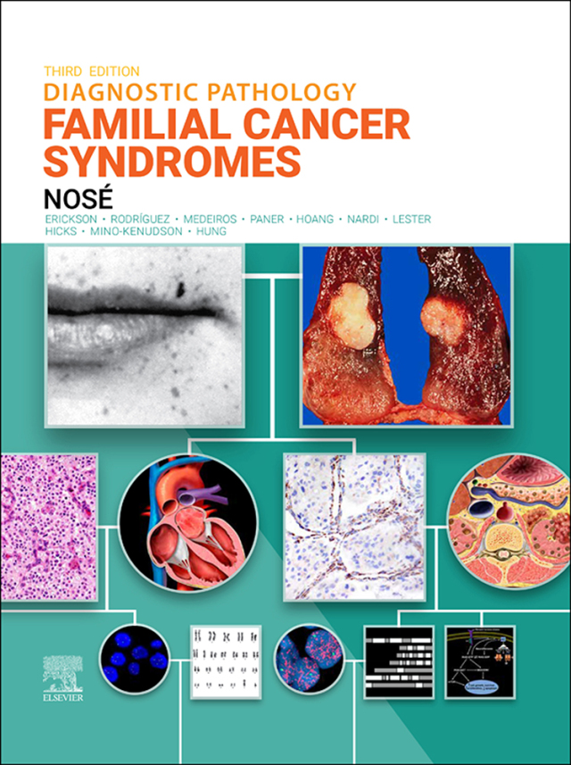 Diagnostic Pathology: Familial Cancer Syndromes