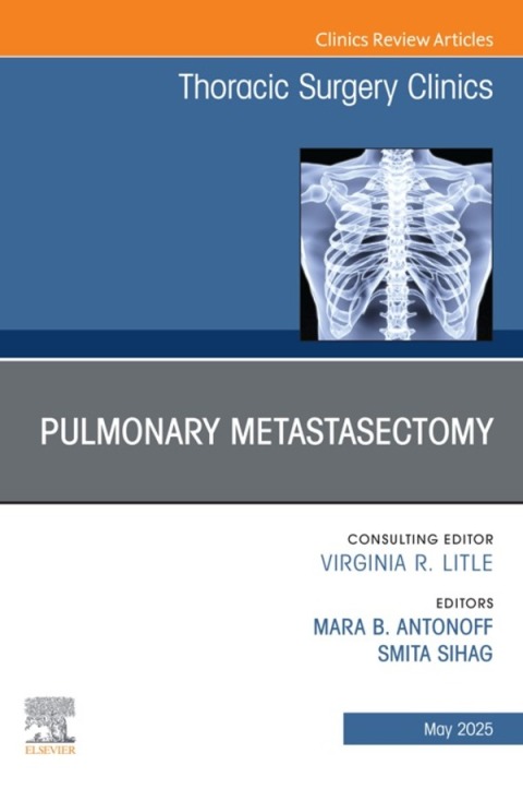 Cover image for book Pulmonary Metastasectomy, An Issue of Thoracic Surgery Clinics